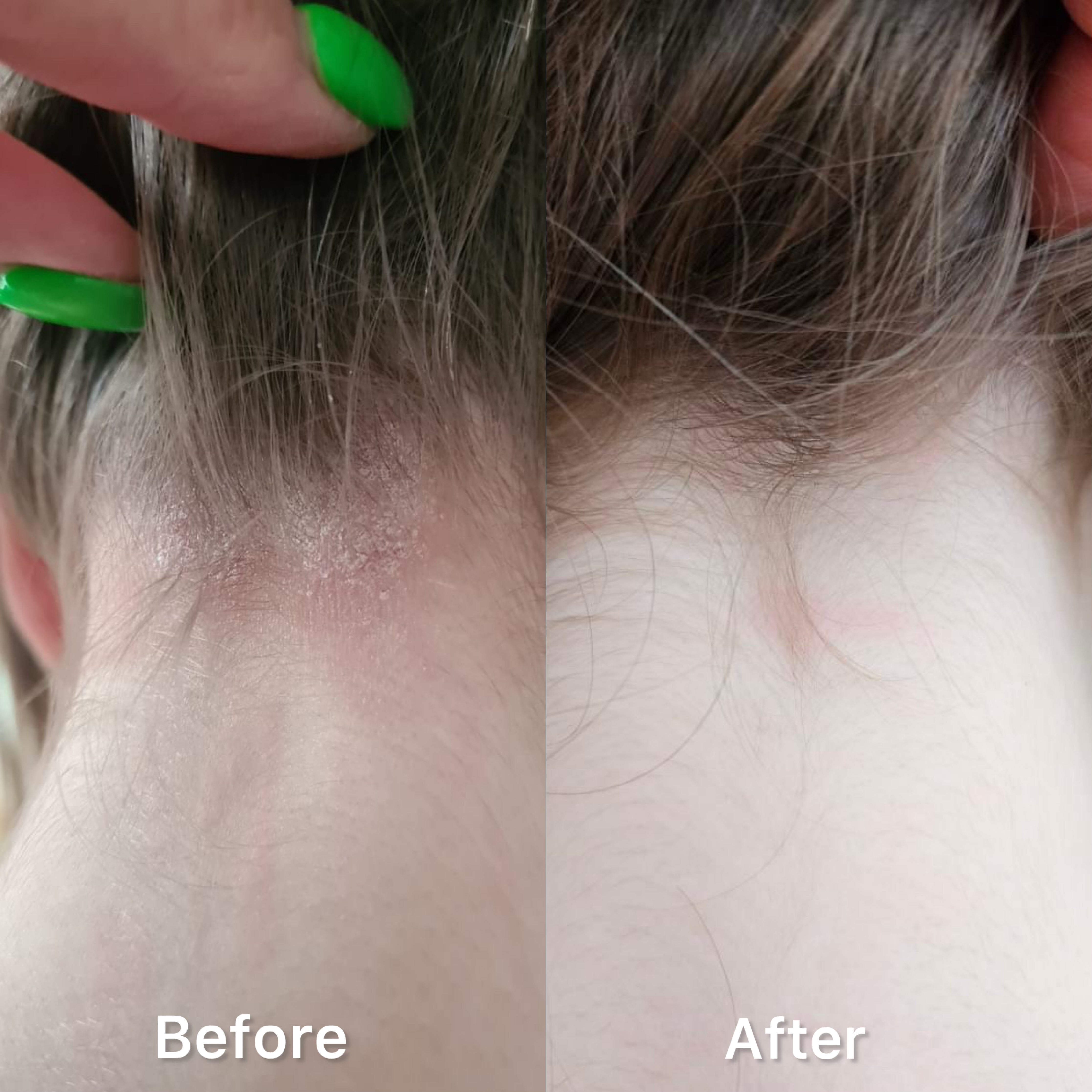 Eczema Oat Cream | Pretty Curly Girl | Natural skin relief cream | Vegan skincare | Havercrème voor gevoelige en eczeemgevoelige huid | Verzachtende en hydraterende crème met haverextract | Gentle oat cream for dry and irritated skin